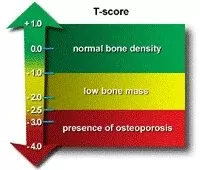 T-Score